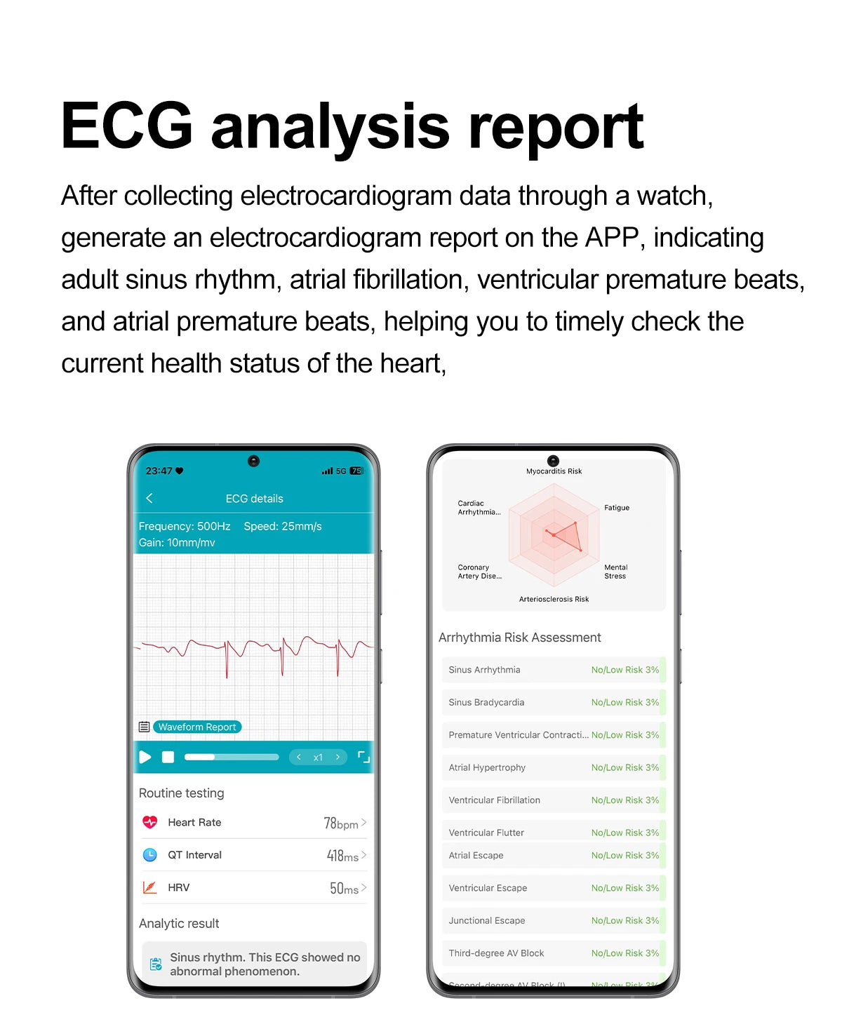 2025 New Accurate Measure Blood oxygen Lipids Uric Acid Smart Watch Men ECG Blood Pressure Health SmartWatches For Android ios