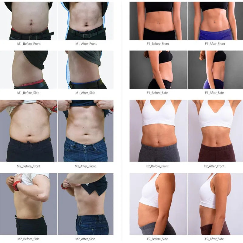 EMS MYOslim Body Sculpt Machine RF Sculpting Electromagnetic Stimulate Body Slimming Machines Muscle Build 6500W 4 5 Handles