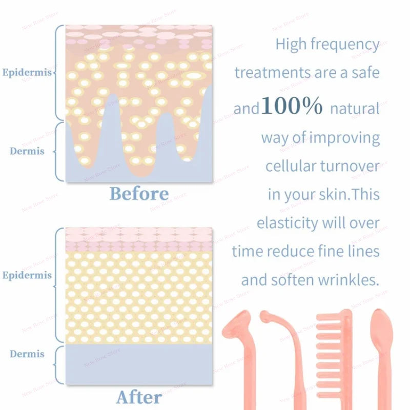 Portable Electrical High Frequency Facial Beauty Machine for Acne Treatment Skin Tightening and Detox