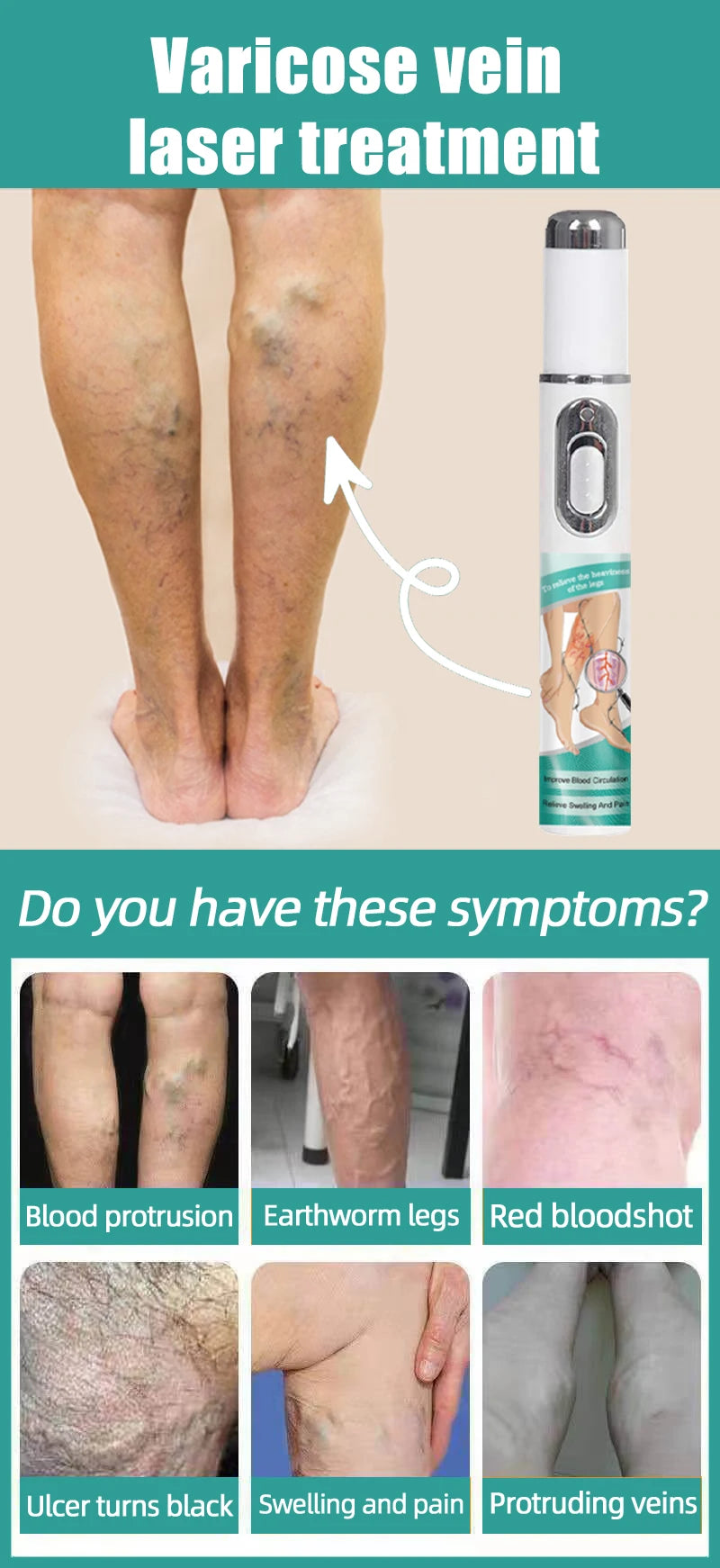 2026 Best-Selling Blue Light Leg Vein Repair Device – Restoring Leg Health