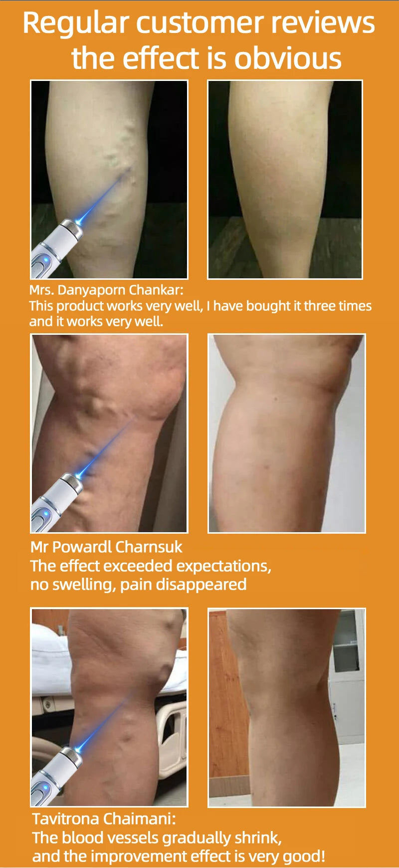 2026 Best-Selling Blue Light Leg Vein Repair Device – Restoring Leg Health
