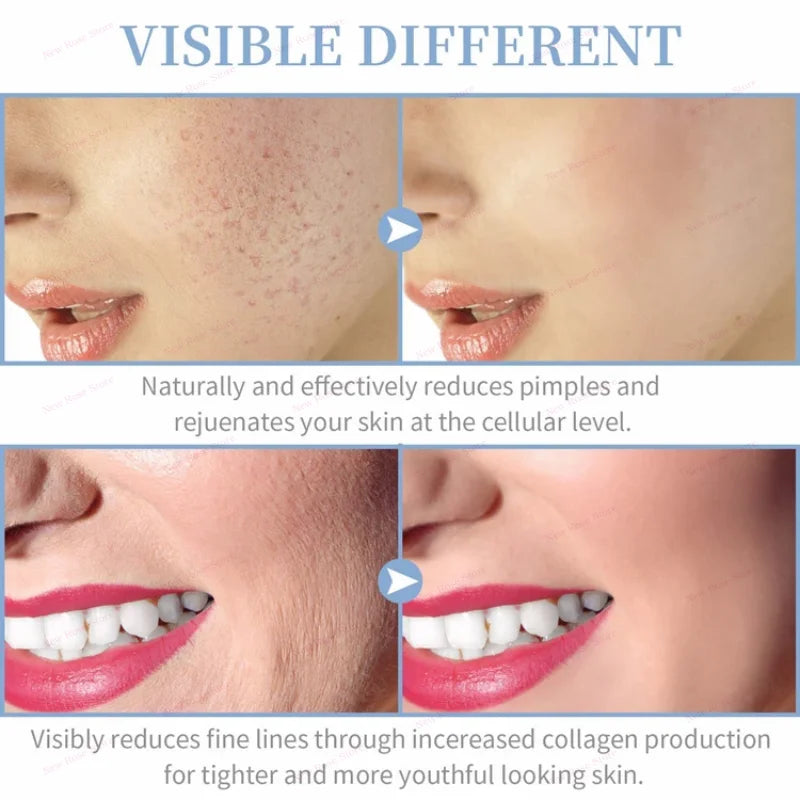 Portable Electrical High Frequency Facial Beauty Machine for Acne Treatment Skin Tightening and Detox