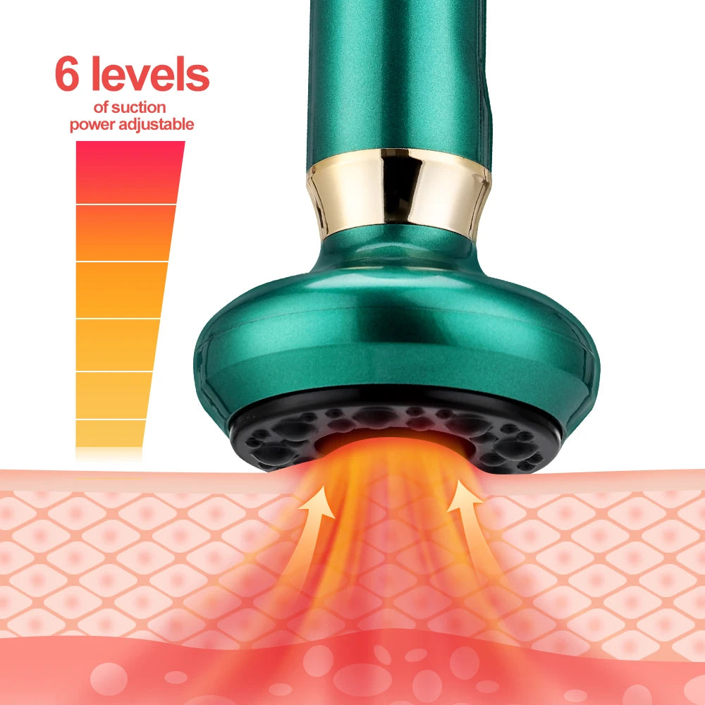6 Gear Electric Cupping Massager Vacuum Suction Cup GuaSha Anti Cellulite Beauty Health Scraping Heat Body Slimming Massage