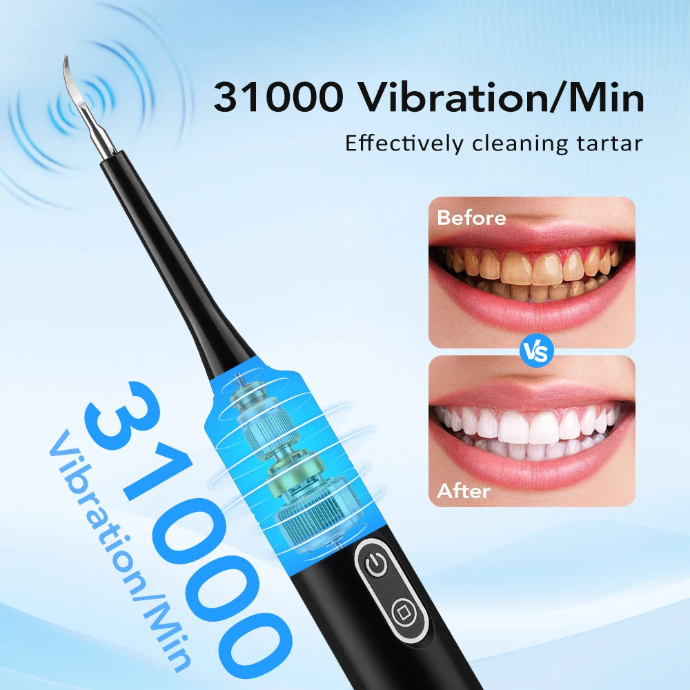Electric Teeth Cleaner 6-gear Modes Portable Toothbrush Tartar Remover High Frequency Vibration Tartar Cleaning Whitening Teeth