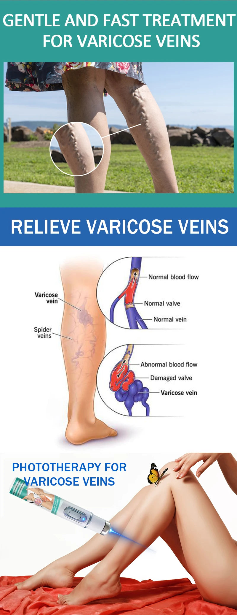 2026 Best-Selling Blue Light Leg Vein Repair Device – Restoring Leg Health