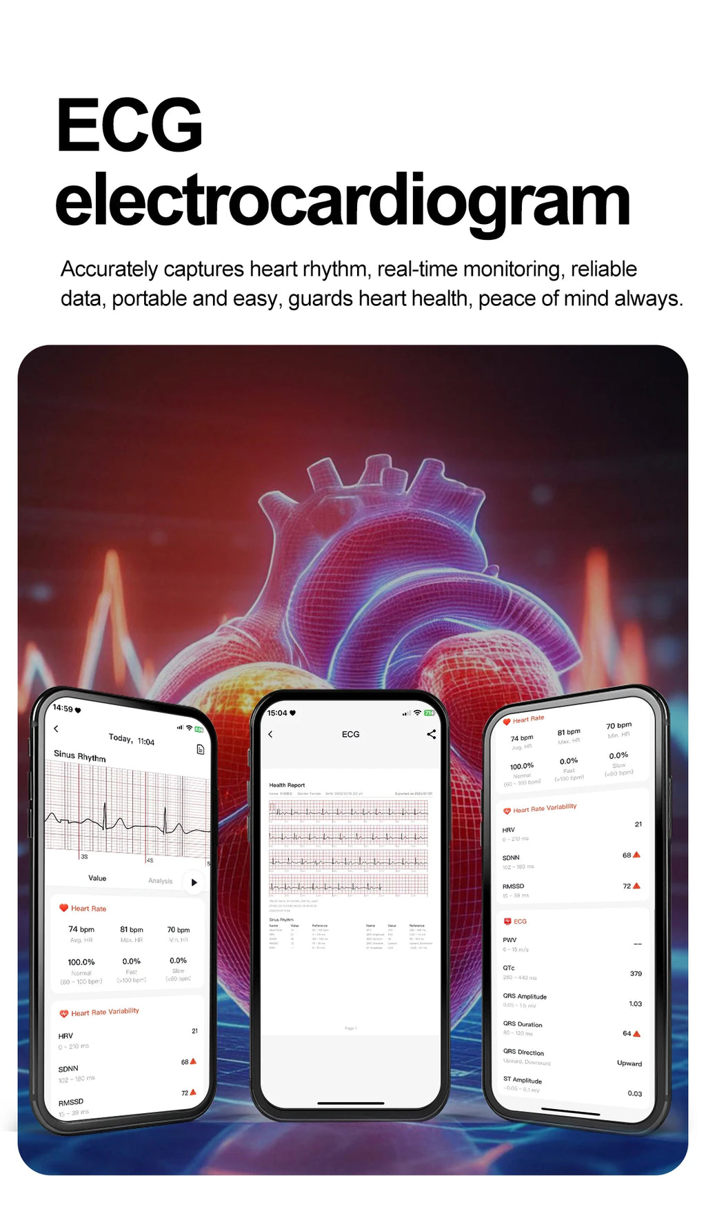 2026New Accurate Diagnosis Smart Watch ECG Blood Oxygen BP Uric Acid Lipids HD AMOLED Screen BT Call Health Smartwatch Men Women
