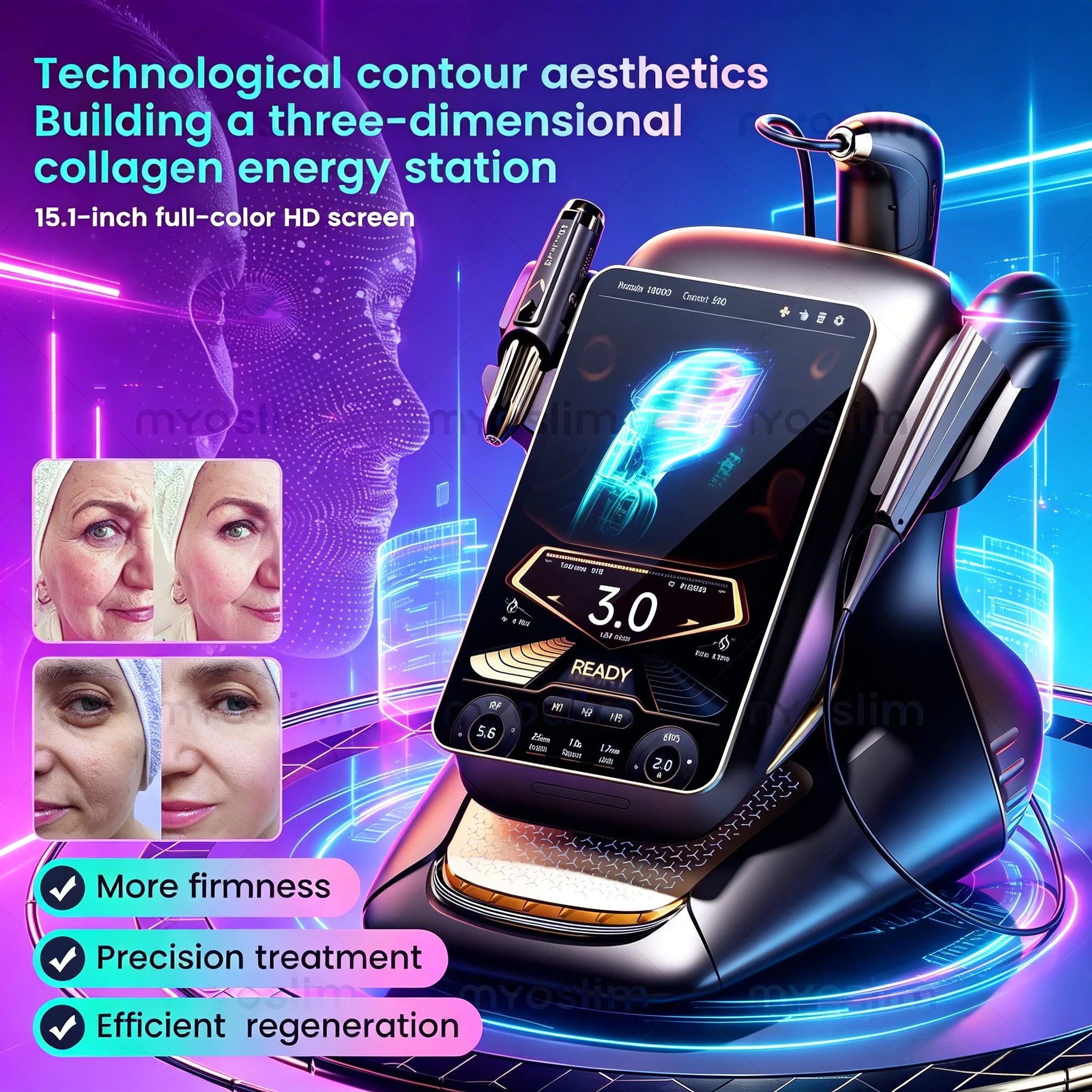 Portable 25D 360 Max Rf Lift Facial Lift Body Lift Skin Firming Anti-aging Skin Rejuvenation Firming Machine Salon.