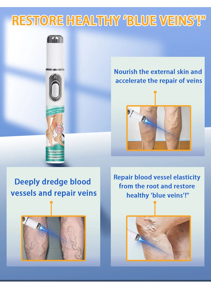 2026 Best-Selling Blue Light Leg Vein Repair Device – Restoring Leg Health