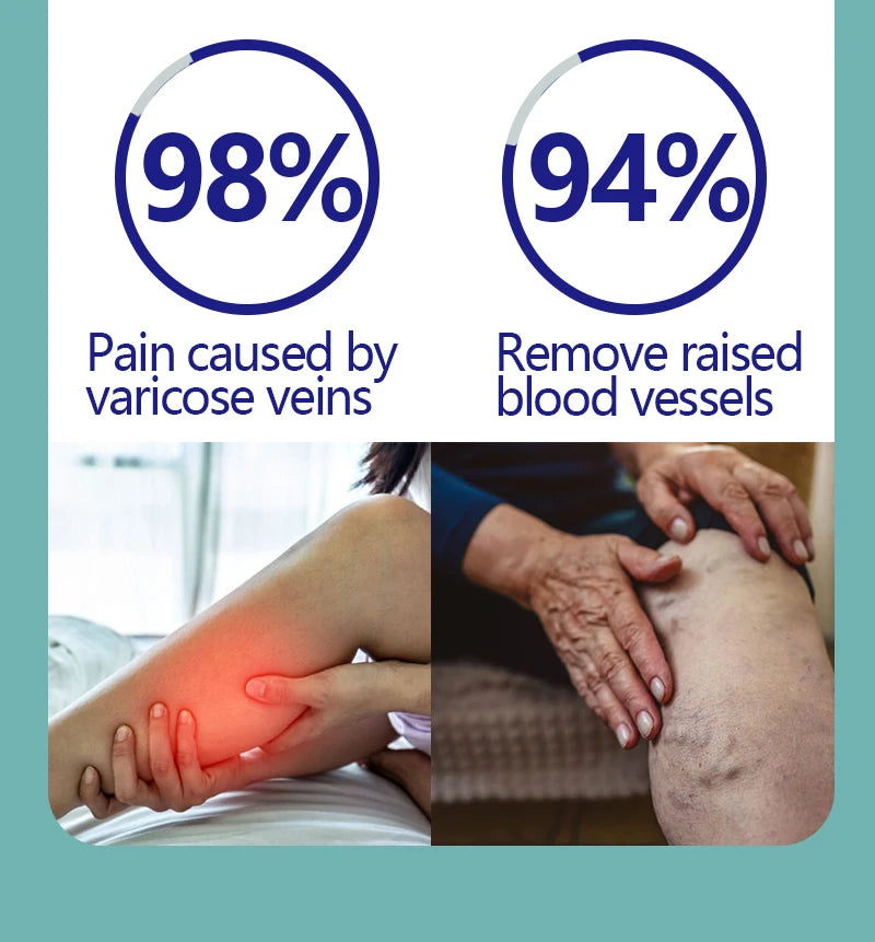 2026 Best-Selling Blue Light Leg Vein Repair Device – Restoring Leg Health