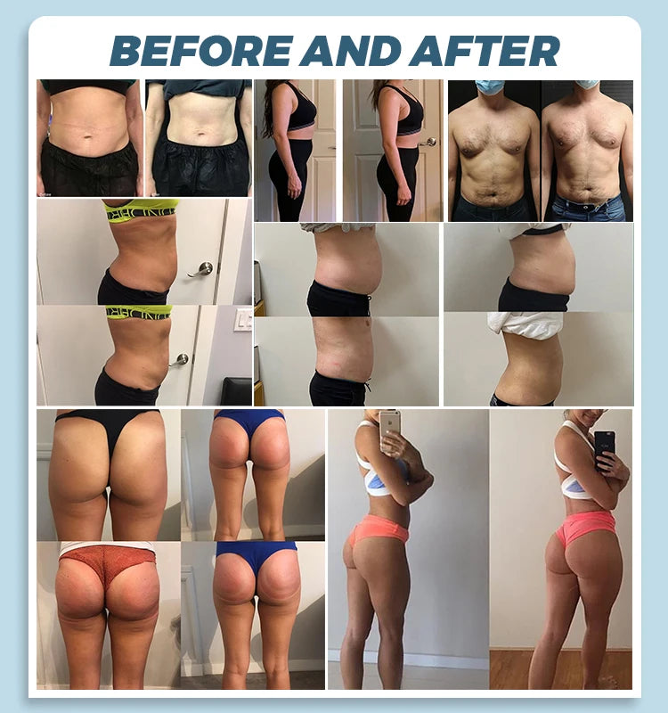 EMS MYOslim Body Sculpt Machine RF Sculpting Electromagnetic Stimulate Body Slimming Machines Muscle Build 6500W 4 5 Handles