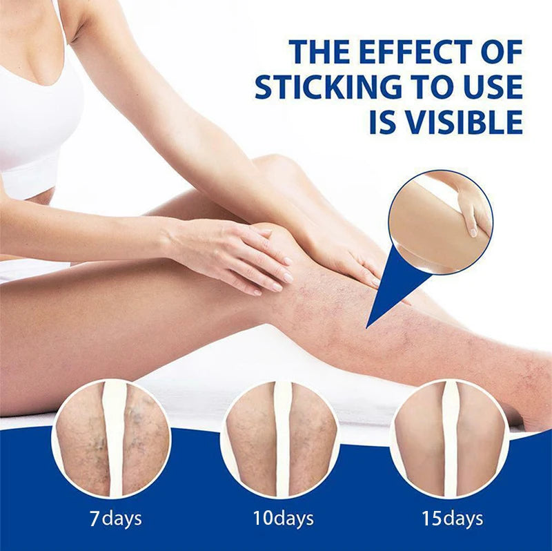 2026 Best-Selling Blue Light Leg Vein Repair Device – Restoring Leg Health