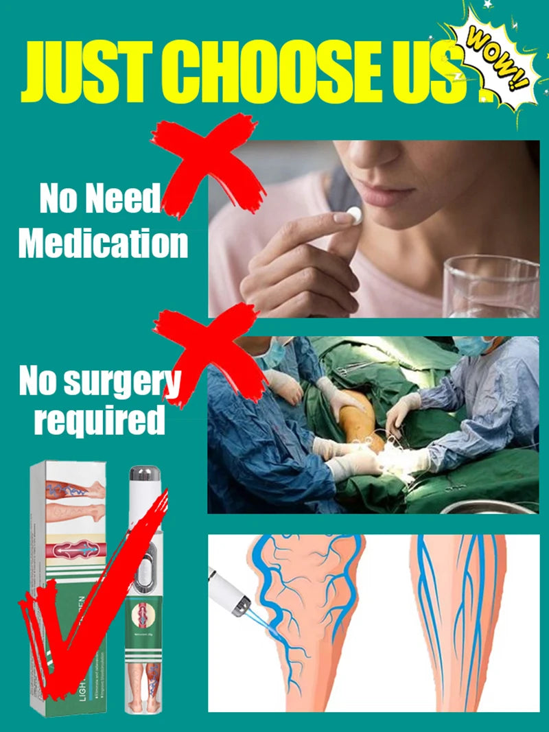 New nano-laser device For varicose veins High-quality varicose vein device