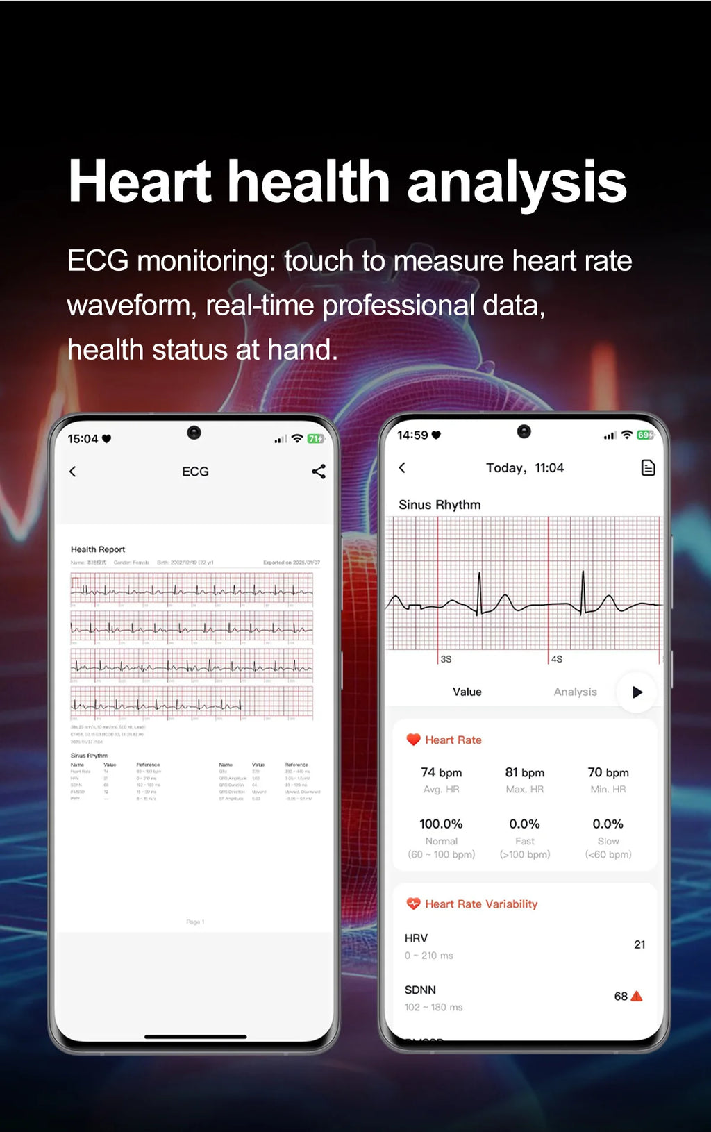 2026 New Body Fat Analysis Health Smart Watch ECG+PPG Uric Acid Blood Pressure Blood Oxygen Clock Call Smart Watch For Men Women
