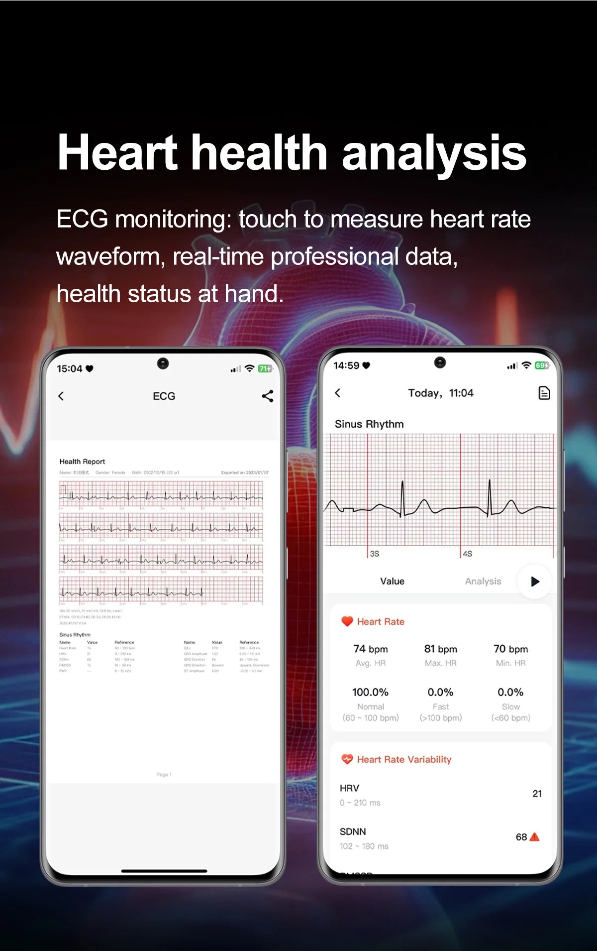 2026 New Body Fat Analysis Health Smart Watch ECG+PPG Uric Acid Blood Pressure Blood Oxygen Clock Call Smart Watch For Men Women