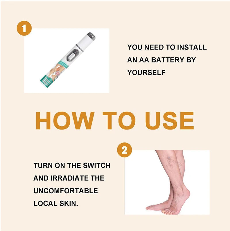 2026 Best-Selling Blue Light Leg Vein Repair Device – Restoring Leg Health
