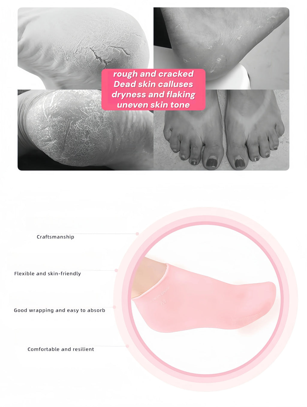 Moisturizing Foot Socks,Silicone Socks for Dry Cracked Feet Women's Foot Socks for Moisturizing,Featuring Massage
