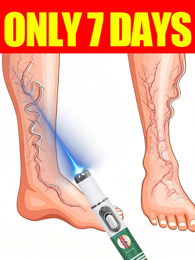New nano-laser device For varicose veins High-quality varicose vein device