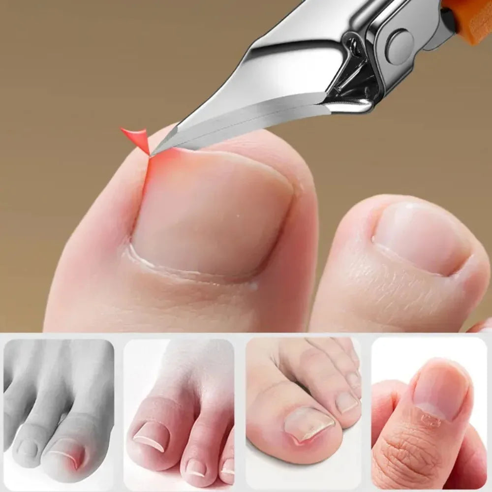 25° Slant Edge Nail Clipper Wide Opening Stainless Steel Professional Ingrown Toenail Tools Eagle Beak Oblique Toe Nail Trimmers