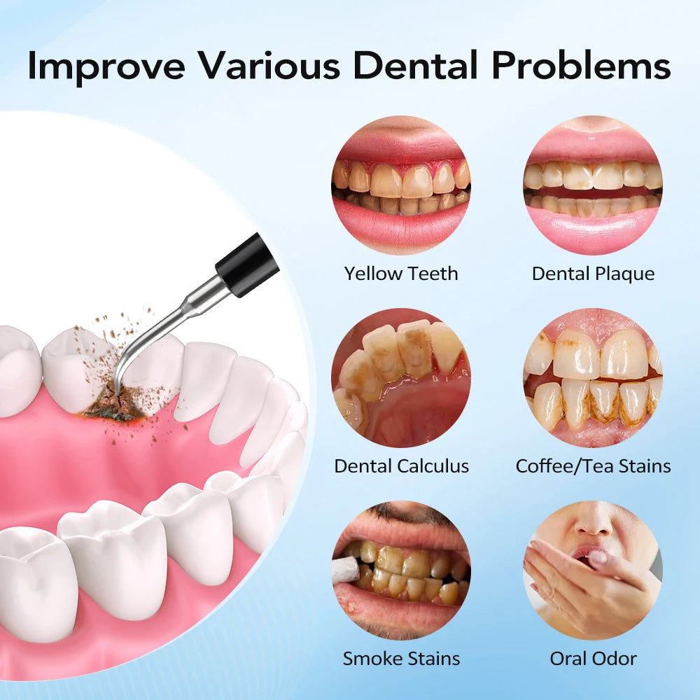 Electric Teeth Cleaner 6-gear Modes Portable Toothbrush Tartar Remover High Frequency Vibration Tartar Cleaning Whitening Teeth
