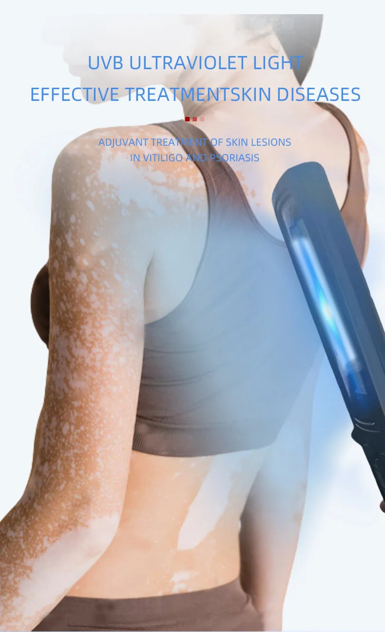Home Use Psoriasis Equipment 308nm UV Lamps Phototherapy Medical Device UvbTreatment Light For Vitiligo