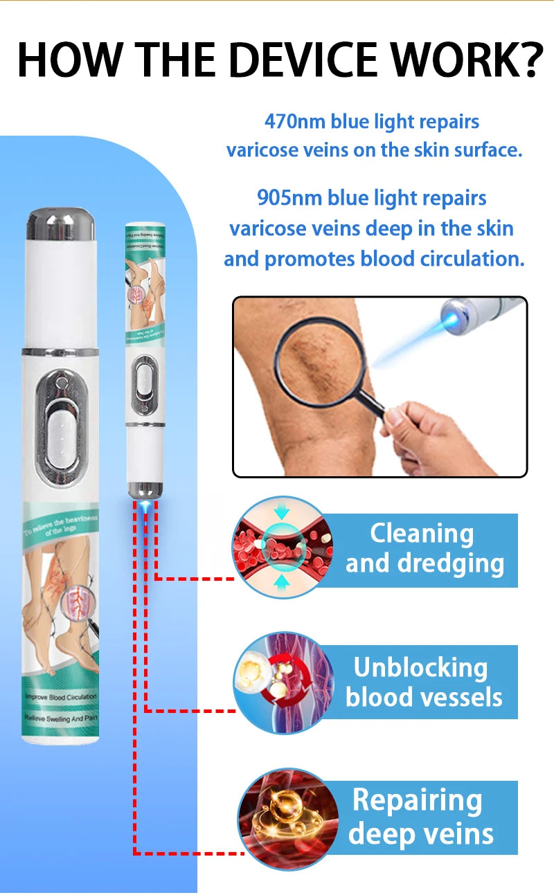 2026 Best-Selling Blue Light Leg Vein Repair Device – Restoring Leg Health