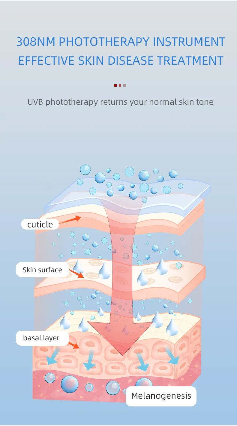 Home Use Psoriasis Equipment 308nm UV Lamps Phototherapy Medical Device UvbTreatment Light For Vitiligo